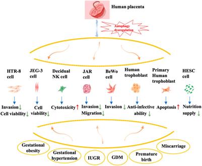 When autophagy meets placenta development and pregnancy complications